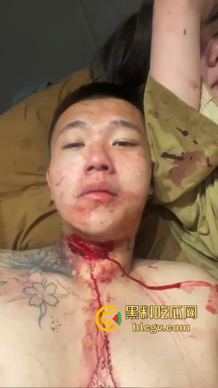 朋友圈成了血腥展示场?王湳权手刃女友后发朋友圈,画面直击心灵,血腥内容慎入!-13