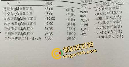 瓜友独家投稿曝光生化母体!化大附中卖淫骚鸡【余纯】600约炮单男,黑丝操逼颜射贱脸!独家流出!-8