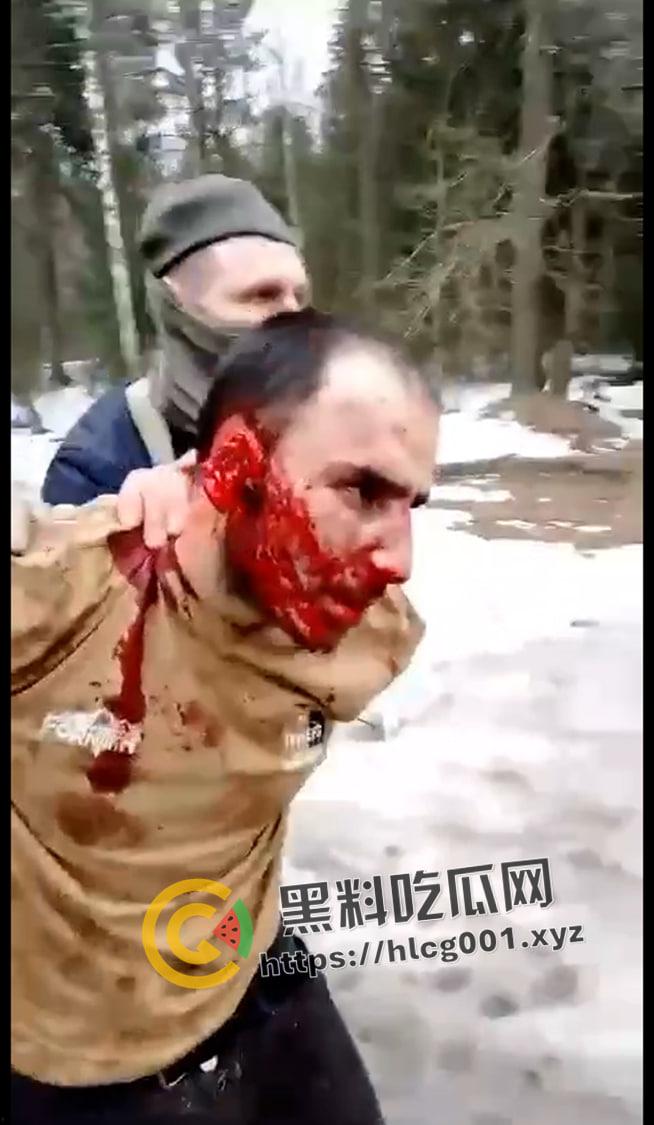 俄罗斯音乐厅恐怖袭击 恐怖分子放出第一视角 枪杀完还要补刀 以及被抓住后处决现场 血腥慎点!-4