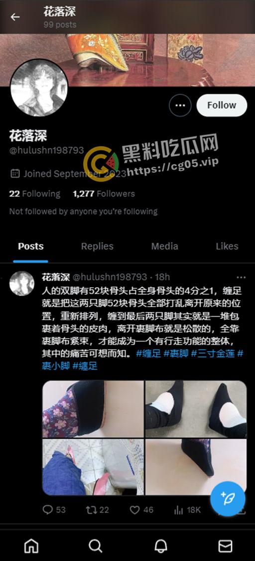 新时代裹脚女性！00后女生爱上裹脚 推特分享裹脚经历 把脚缠到骨折变形 吓人！-1