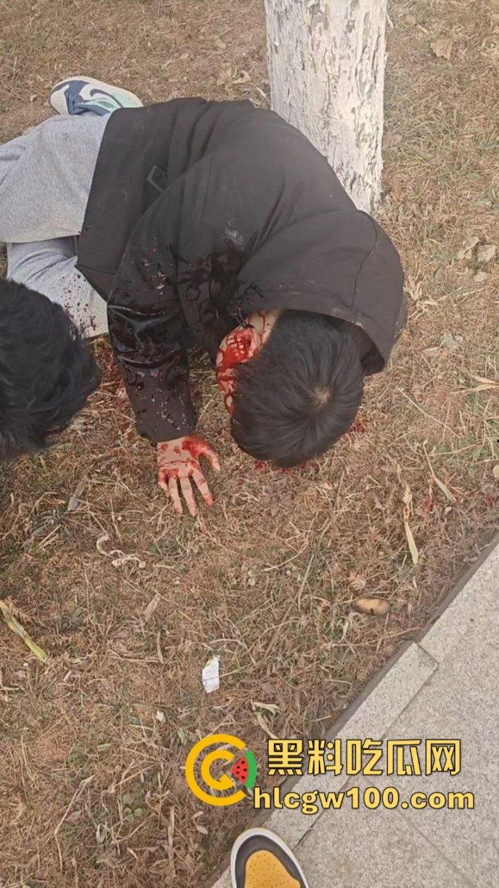 山东临沂精神小伙为抢女神交配权带兄弟持刀砍情敌 拉架小哥惨遭爆头当场脑袋开花 现场爆血视频流出！-8